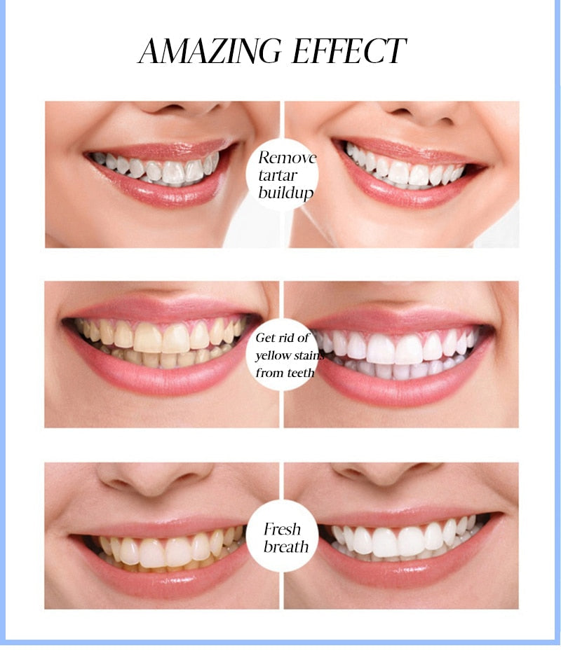 BrightSmilez™ Pióro do wybielania zębów